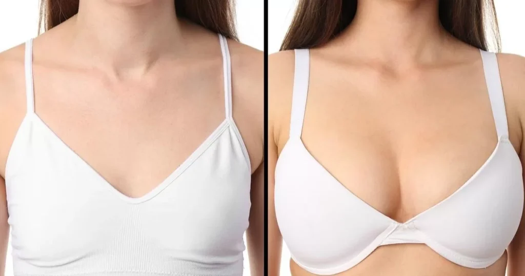 Best Doctors in Dubai Your Guide to Breast Augmentation Procedures