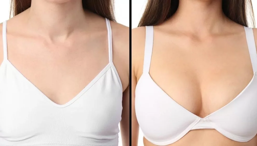 Best Doctors in Dubai Your Guide to Breast Augmentation Procedures