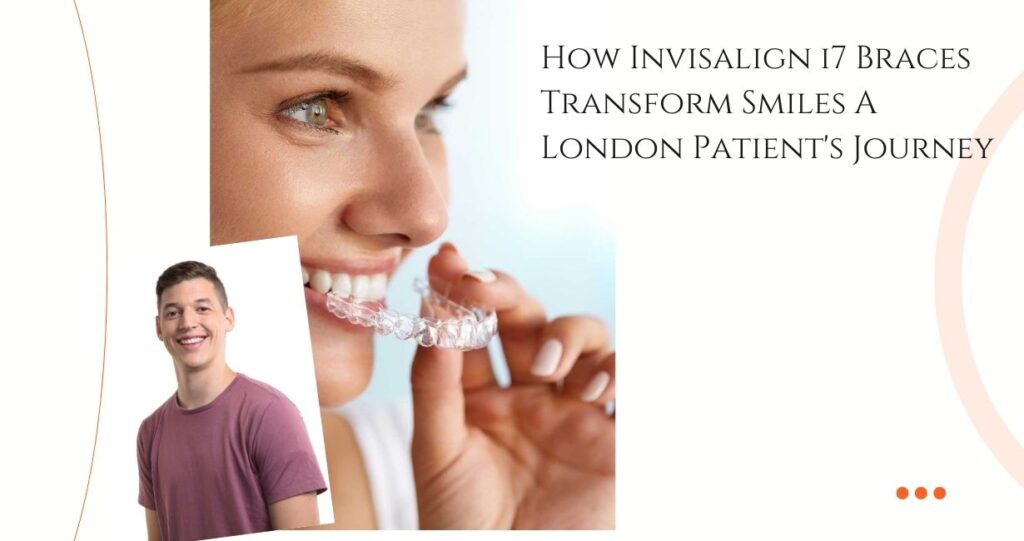 Invisalign i7