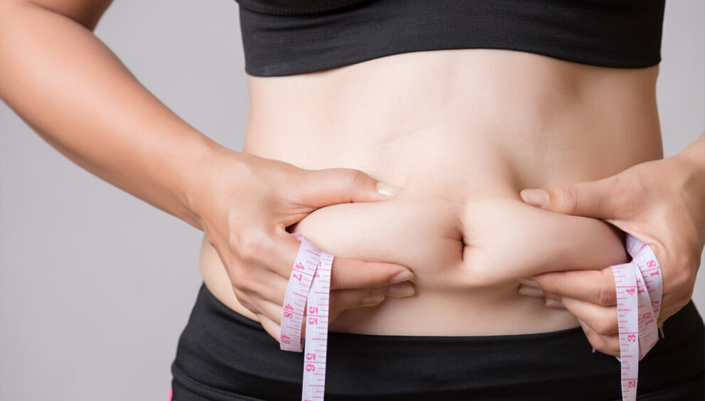 Liposuction in Dubai