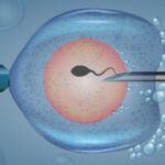 best ivf treatment in dubai